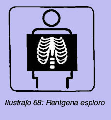 Rentgena esploro